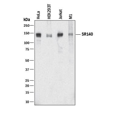 Detection of Human and Mouse SR140 antibody by Western Blot.