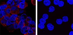 SR-AI/MSR antibody in THP-1 Human Cell Line by Immunocytochemistry (ICC).