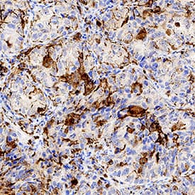 SR-AI/MSR antibody in Human Lung Tissue by Immunohistochemistry (IHC-P).