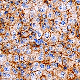 SR-BI antibody in Human Liver by Immunohistochemistry (IHC-P).