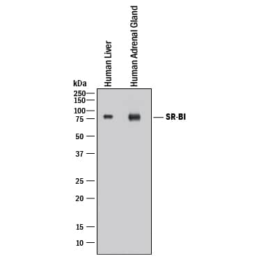 Detection of Human SR-BI antibody by Western Blot.