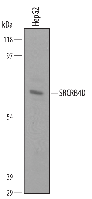 Detection of Human SRCRB4D antibody by Western Blot.