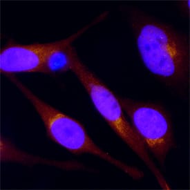 SREBP2 antibody in HeLa Human Cell Line by Immunocytochemistry (ICC).