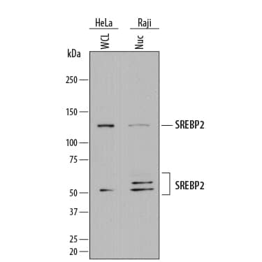 Detection of Human SREBP2 antibody by Western Blot.