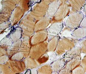 SRPK3 antibody in Human Skeletal Muscle by Immunohistochemistry (IHC-P).
