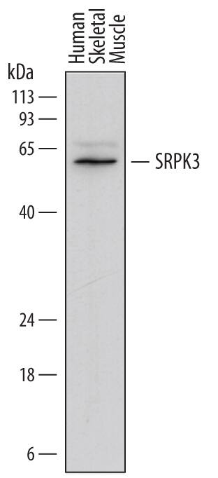 Detection of Human SRPK3 antibody by Western Blot.