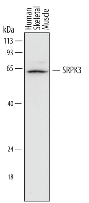 Detection of Human SRPK3 antibody by Western Blot.