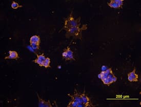 SSEA-3 antibody in BG01V Human Stem Cells by Immunocytochemistry (ICC).