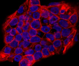 SSEA-1 antibody in D3 Mouse Cell Line by Immunocytochemistry (ICC).