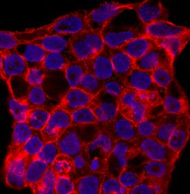 SSEA-1 antibody in D3 Mouse Cell Line by Immunocytochemistry (ICC).