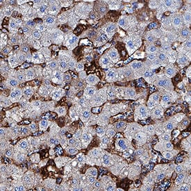 ST2/IL-33 R antibody in Human Liver by Immunohistochemistry (IHC-P).