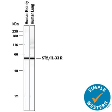Detection of Human ST2/IL-33 R antibody by Simple WesternTM.