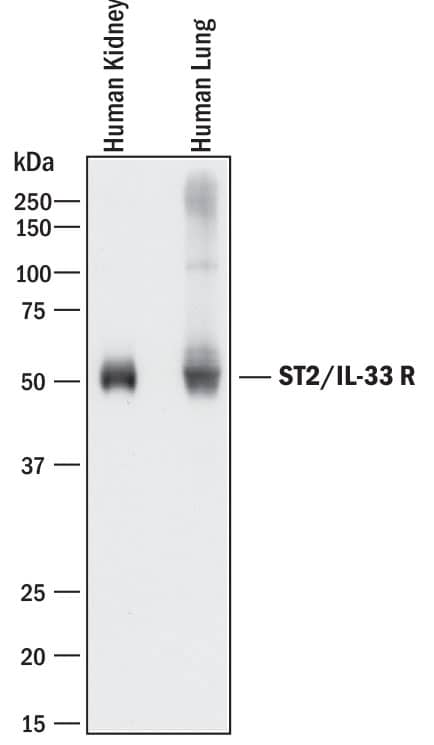 Detection of Human ST2/IL-33 R antibody by Western Blot.