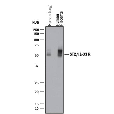 Detection of Human ST2/IL-33 R antibody by Western Blot.