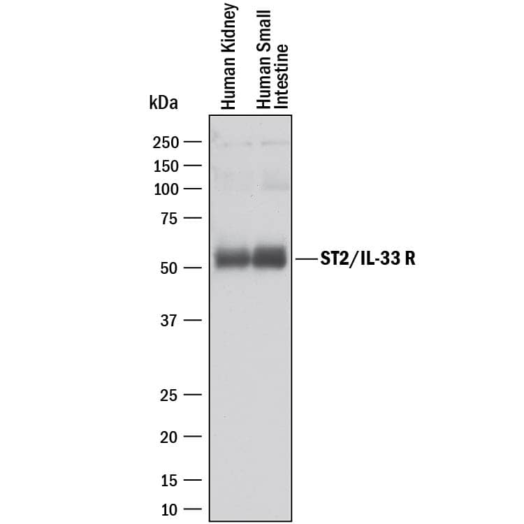 Detection of Human ST2/IL-33 R antibody by Western Blot.