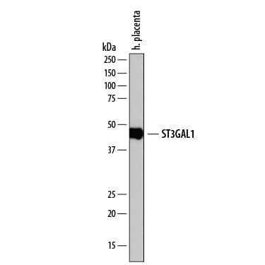 Detection of Human ST3  beta-Gal a-2,3-Sialyltransferase 1/ST3GAL1 antibody by Western Blot.