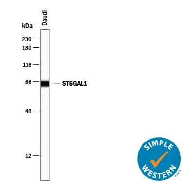 Detection of Human ST6 Gal Sialyltransferase 1/ST6GAL1 antibody by Simple WesternTM.