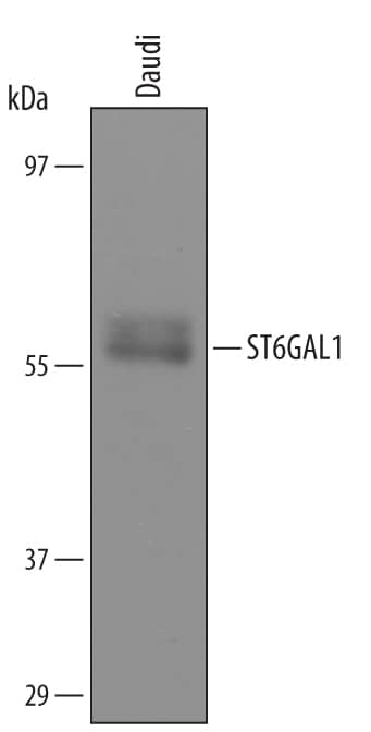 Detection of Human ST6GAL1 antibody by Western Blot.