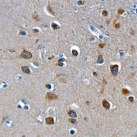 ST6 Gal Sialyltransferase 2/ST6GAL2 antibody in Human Brain by Immunohistochemistry (IHC-P).