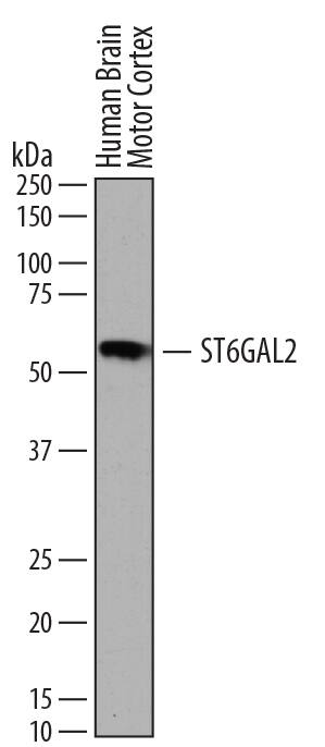 Detection of Human ST6 Gal Sialyltransferase 2/ST6GAL2 antibody by Western Blot.