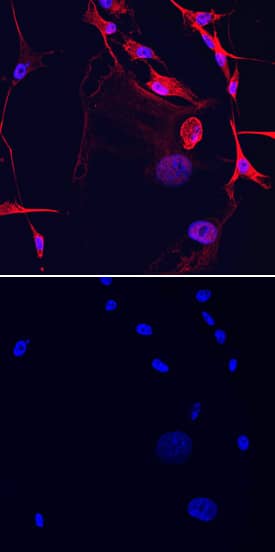 GalNAc a-2,6-sialyltransferase V/ST6GALNAC5 antibody in MDA-MB-231 Human Cell Line by Immunocytochemistry (ICC).