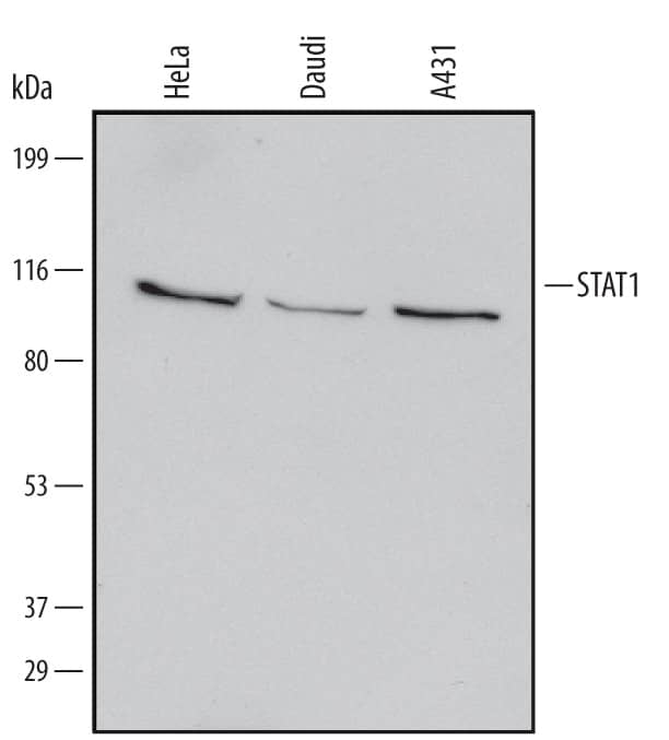 Detection of Human STAT1 antibody by Western Blot.