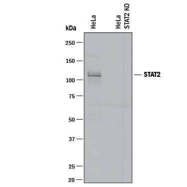 Western Blot Show Human STAT2 Antibody Specificity Using Knockout Cell Line.