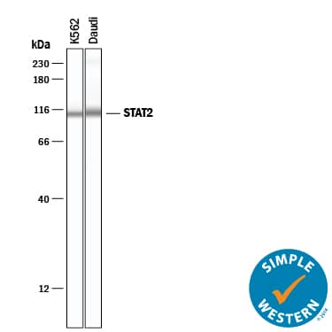 Detection of Human STAT2 antibody by Simple WesternTM.