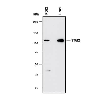 Detection of Human STAT2 antibody by Western Blot.