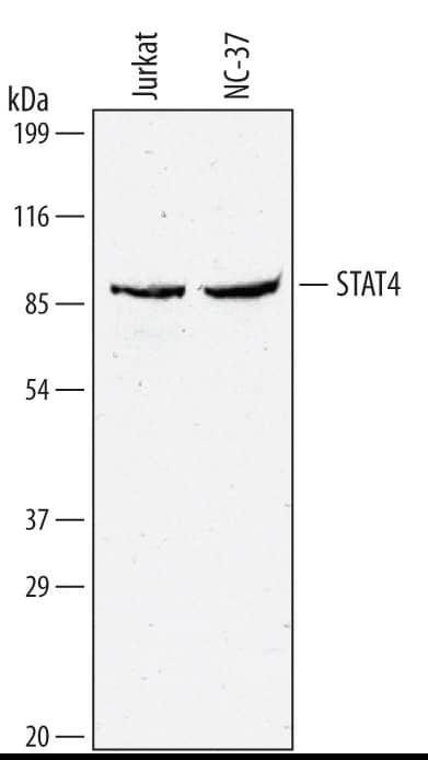 Detection of Human STAT4 antibody by Western Blot.