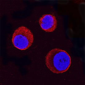 STAT5a antibody in K562 Human Cell Line by Immunocytochemistry (ICC).