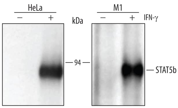 Immunoprecipitation of Human and Mouse STAT5b.