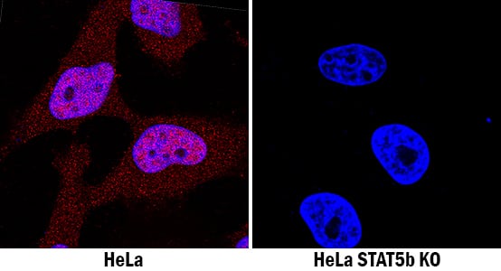 STAT5b Antibody Specificity is Shown by Immunocytochemistry antibody in Knockout Cell Line.