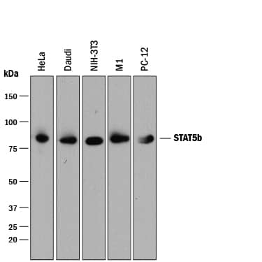 Detection of Human, Mouse, and Rat STAT5b antibody by Western Blot.