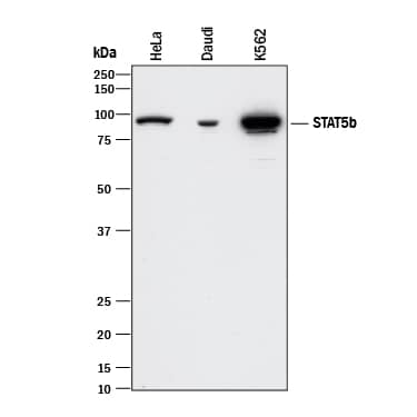 Detection of Human STAT5b antibody by Western Blot.