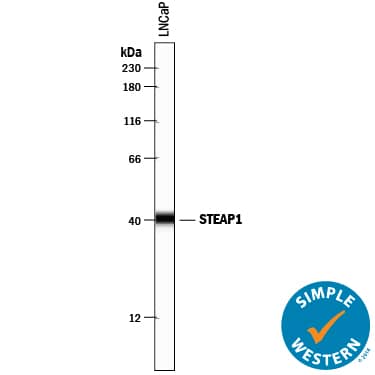 Detection of Human STEAP1 antibody by Simple WesternTM.