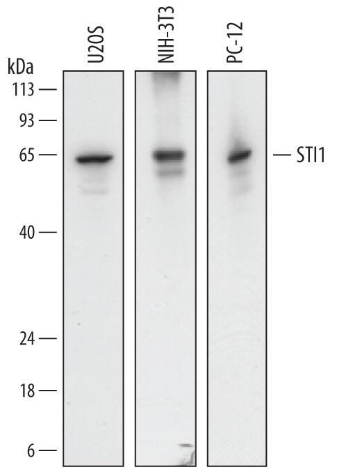 Detection of Human, Mouse, and Rat STI1 antibody by Western Blot.