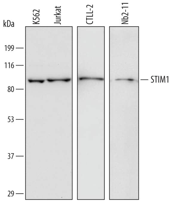 Detection of Human, Mouse, and Rat STIM1 antibody by Western Blot.