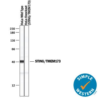 Detection of Human STING/TMEM173 antibody by Simple WesternTM.