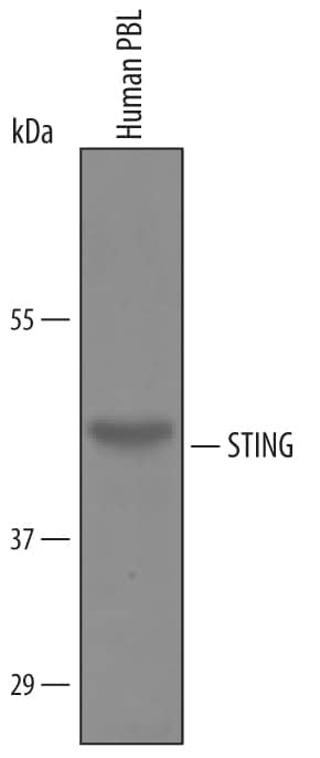 Detection of Human STING/TMEM173 antibody by Western Blot.