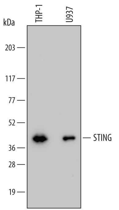 Detection of Human STING/TMEM173 antibody by Western Blot.