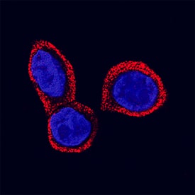 STRA6 antibody in Raji Human Cell Line by Immunocytochemistry (ICC).