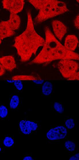 STYK1 antibody in PC-3 Human Cell Line by Immunocytochemistry (ICC).