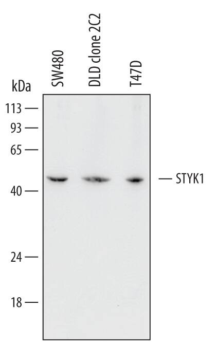 Detection of Human STYK1 antibody by Western Blot.