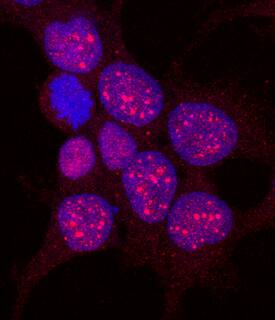 SUMO3 antibody in HEK293 Human Cell Line by Immunocytochemistry (ICC).