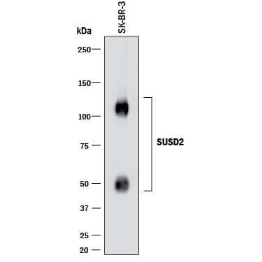 Detection of SUSD2 antibody by Western Blot.