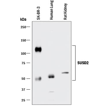 Detection of SUSD2 antibody by Western Blot.