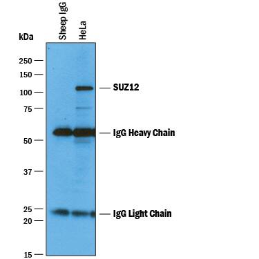 Immunoprecipitation of Human SUZ12.