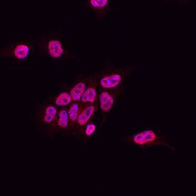 SUZ12 antibody in D3 Mouse Cell Line by Immunocytochemistry (ICC).