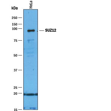 Immunoprecipitation of Human SUZ12.